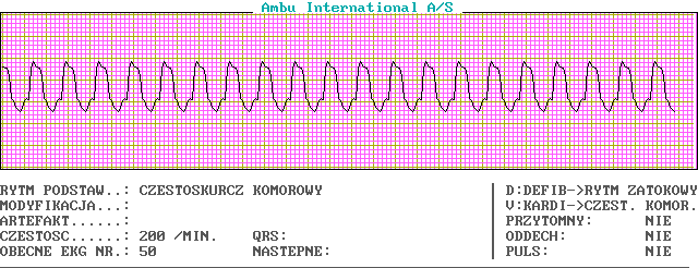 EKG wykresy z łyżek, Pierwsza Pomoc - c50-0.png